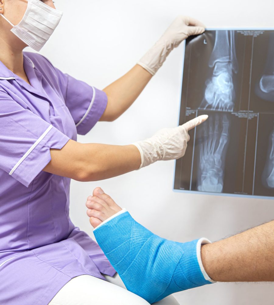 Female doctor in a blue medical gown checking broken leg and shows the male patient lateral projection x-ray of foot and ankle.